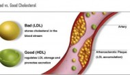 IMPROVE-IT印證特定區(qū)間內(nèi)LDL-C越低越好，稱膽固醇原則（LDL Principle）為時(shí)尚早
