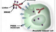 Progenics制藥公司報(bào)道抗體藥物偶聯(lián)物PSMA ADC的積極臨床結(jié)果