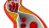四兩撥千斤：PCSK9 siRNA顯示長期療效