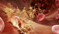 FDA批準(zhǔn)血友病新藥emicizumab