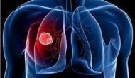 IO組合翻過(guò)喜馬拉雅、T藥進(jìn)入肺癌維持療法